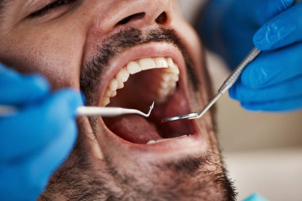 Best Broken Tooth Emergency  in Carrabelle, FL